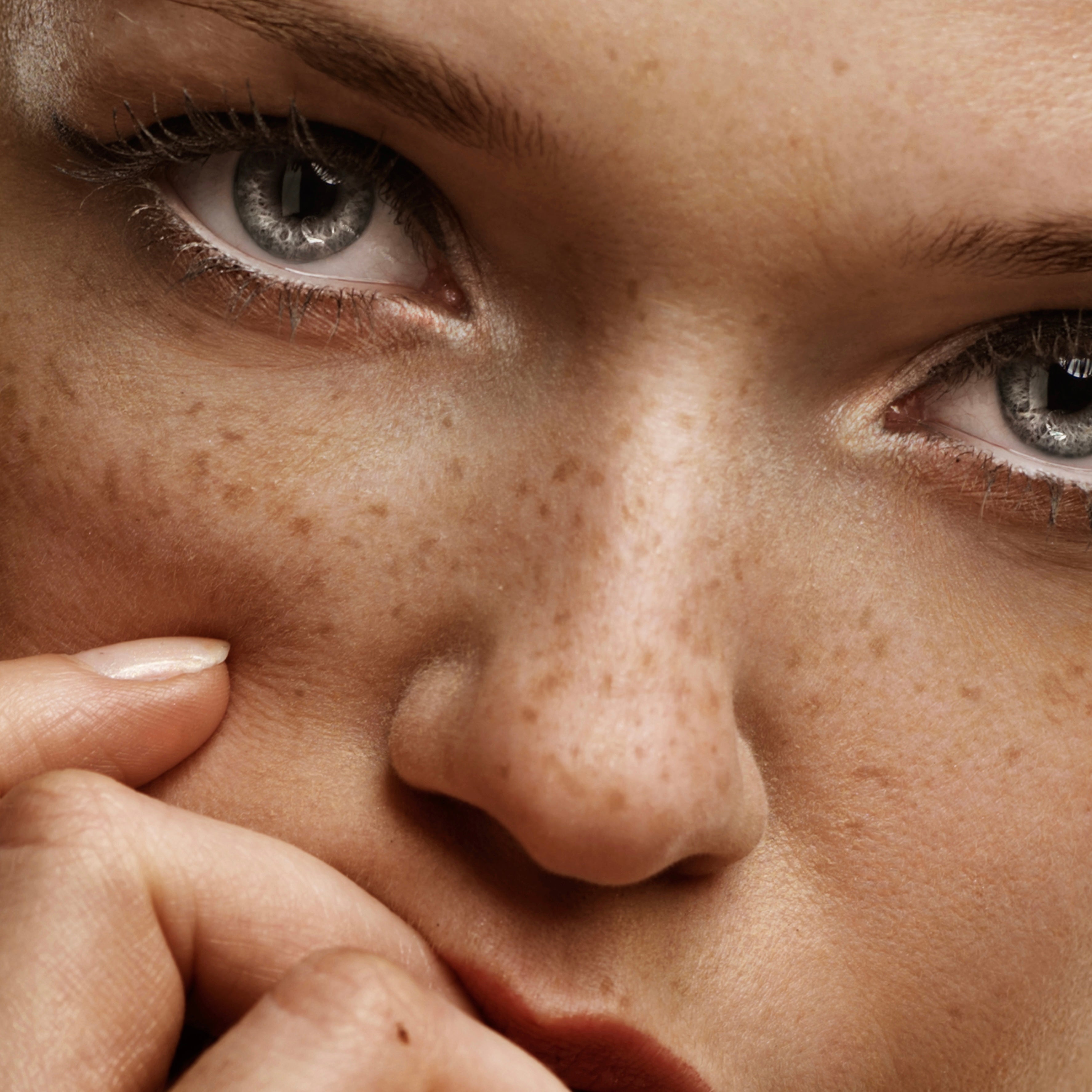 Sun-Kissed Freckles